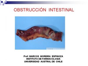 OBSTRUCCIN INTESTINAL Prof MARCOS MOREIRA ESPINOZA INSTITUTO DE