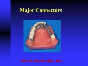 Major Connectors Rola M Shadid BDS MSc Major