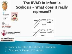 The RVAD in Infantile Scoliosis What does it