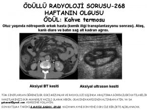 DLL RADYOLOJ SORUSU268 HAFTANIN OLGUSU DL Kahve termosu