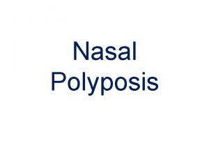 Nasal Polyposis Definition Nasal polyps are nonneoplastic masses