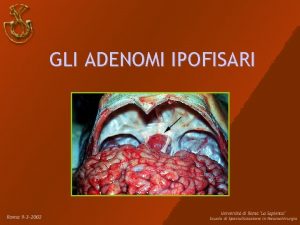 Approccio pterionale Approccio pterionale