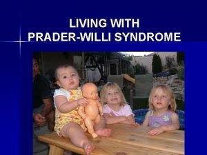Prader willi syndrome symptoms