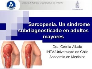 Sarcopenia Un sindrome subdiagnosticado en adultos mayores Dra