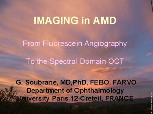 IMAGING in AMD From Fluorescein Angiography To the