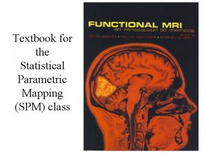 Echo planar imaging Echo planar imaging