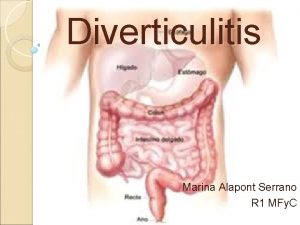 Diverticulitis