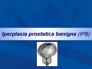 Iperplasia prostatica benigna IPB ricordi di anatomia La