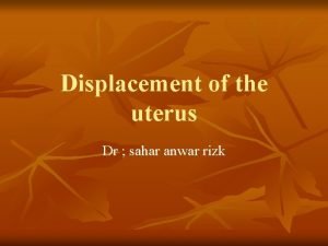 Displacement of the uterus Dr sahar anwar rizk