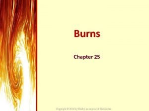 Burns Chapter 25 Copyright 2014 by Mosby an