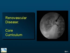 Renovascular Disease Core Curriculum 08 1 Renal Artery