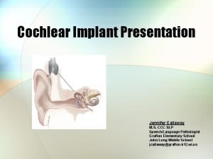 Cochlear Implant Presentation Jennifer Callaway M S CCCSLP