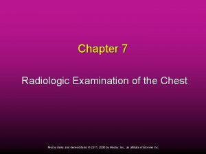Chapter 7 Radiologic Examination of the Chest Mosby