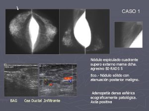 Restos de silicona en axila