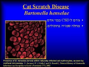 Cat Scratch Disease Bartonella henselae CSD Presence of