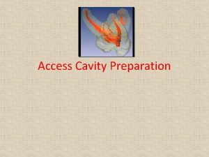 Access cavity shape for lower first molar