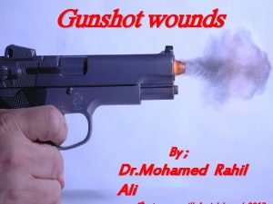 Gunshot wounds By Dr Mohamed Rahil Ali History