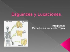 Luxaciones