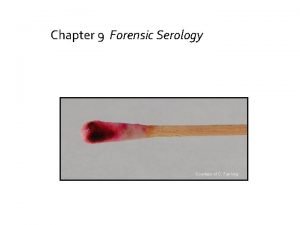 Chapter 9 Forensic Serology Courtesy of C Fanning