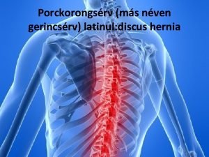 Hernia paraumbilical