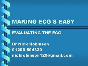 MAKING ECGS EASY EVALUATING THE ECG Dr Nick