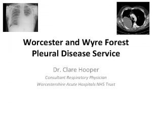 Worcester and Wyre Forest Pleural Disease Service Dr