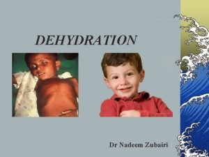 Types of dehydration