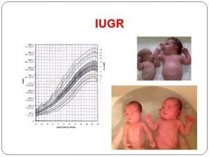 IUGR IUGR Asymmetric IUGR Chronic fetal distress hypoxia