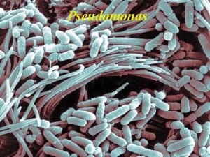 Pseudomonas Pseudomonas Sono microrganismi ubiquitari si trovano nel