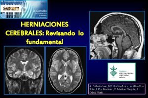 Hernia transtentorial central