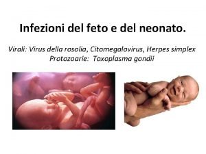 Infezioni del feto e del neonato Virali Virus