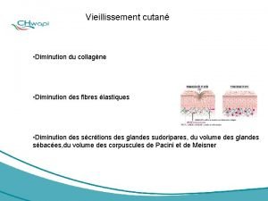 Vieillissement cutan Diminution du collagne Diminution des fibres