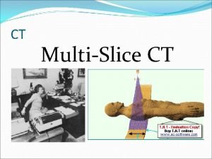 Single slice ct vs multislice ct