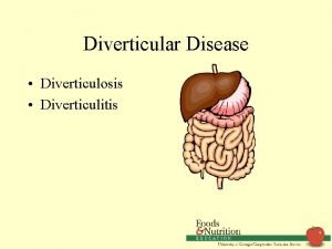 Diverticular Disease Diverticulosis Diverticulitis Diverticulosis Common disease with