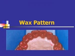Lost wax pattern