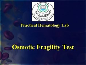 Describe osmotic fragility test