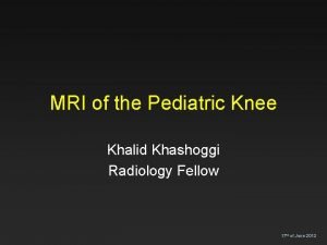 Pediatric knee mri