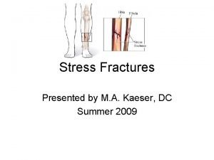 Stress Fractures Presented by M A Kaeser DC