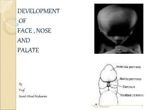 DEVELOPMENT OF FACE NOSE AND PALATE By Prof