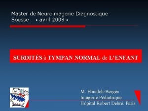 Master de Neuroimagerie Diagnostique Sousse avril 2008 SURDITS