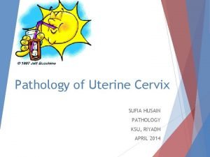 Pathology of Uterine Cervix SUFIA HUSAIN PATHOLOGY KSU