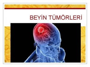 BEYN TMRLER Supratentorial Primer infratentorial Beyin tmrleri Sekonder