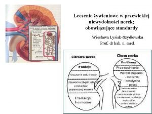 Leczenie ywieniowe w przewlekej niewydolnoci nerek obowizujce standardy