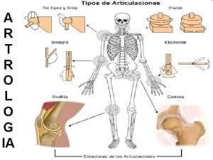 Anfiartrosis verdaderas