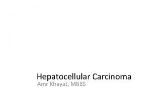 Hepatocellular Carcinoma Amr Khayat MBBS Hepatocellular carcinoma HCC