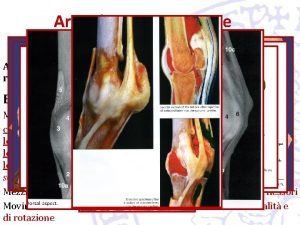 Articolazioni o giunture Articolazioni dellarto toracico Articolazioni metacarpofalangee