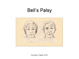 Bells Palsy Neurolgy Chapter of IAP Bells Palsy