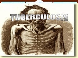 Pulmonary TB BY PROF AZZA EL MEDANY Department