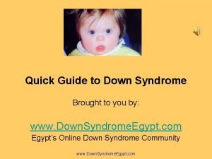 Down syndrome prayer