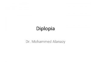 Diplopia Dr Mohammed Alanazy Versions Terminology Esotropia Exotropia